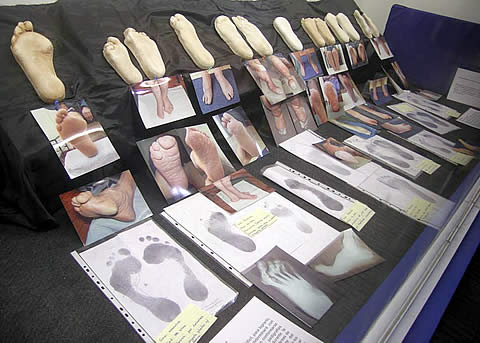 En las vidrieras de «Ortopedia Neo» se estan exponiendo casos de ortopodología, mostrándose soluciones efectivas a enfermedades menores de los pies.